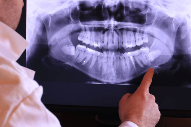 Best Emergency Gum Treatment in Reston, VA